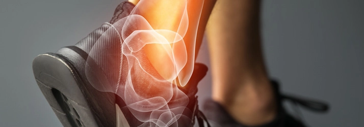 Shockwave Therapy Boynton Beach FL Achilles Pain